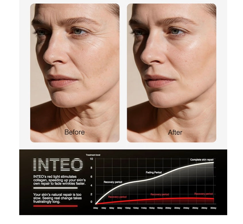 Red Light Therapy Face Mask